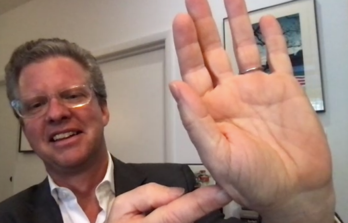 Mayoral candidate Shaun Donovan is a regular cyclist — and has the wounds to prove it. Here he is showing the remnants of an Obama-era crash in D.C.